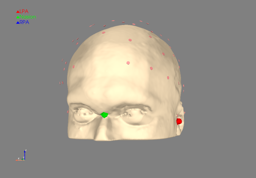 An image showing source reconstruction in action--red dots signify the electrodes on the head.